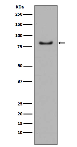 PI 3 Kinase p85 alpha Rabbit mAb