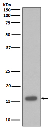 p16 INK Rabbit mAb