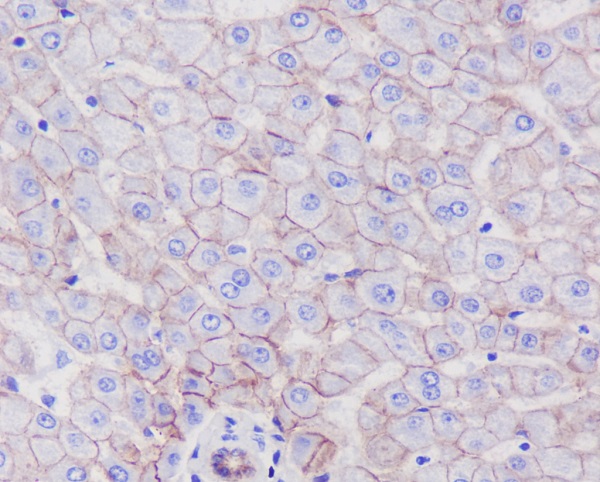 SCARB1 Rabbit mAb