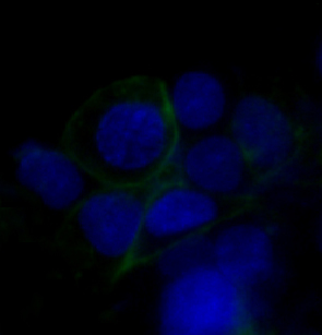 GLUT1 Rabbit mAb