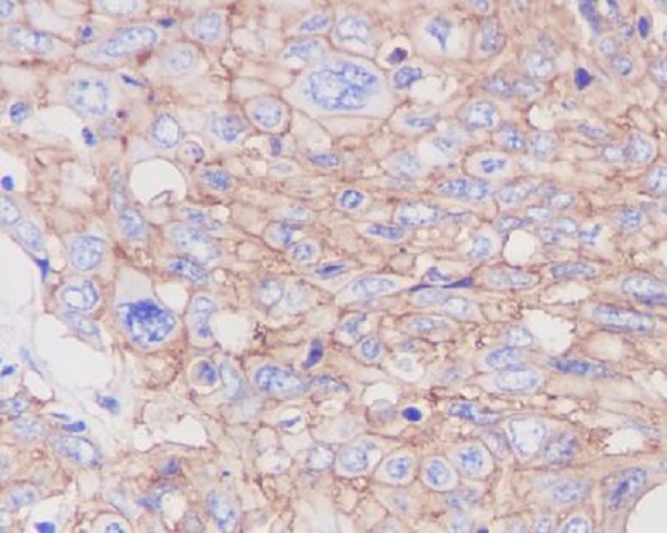 GLUT1 Rabbit mAb