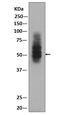 GLUT1 Rabbit mAb