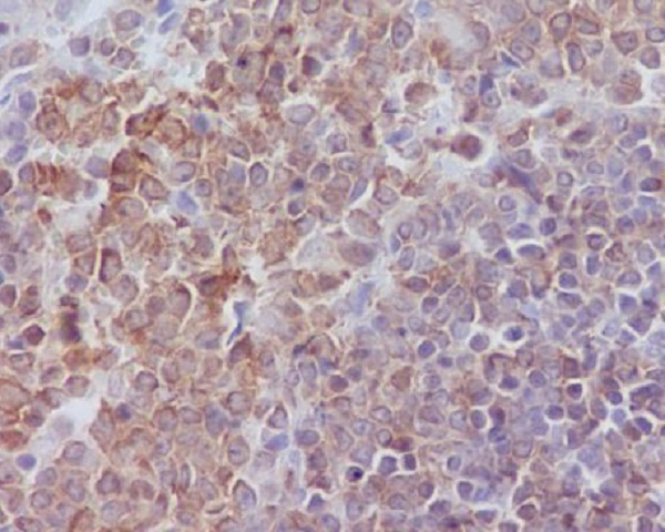 SHP1 Rabbit mAb