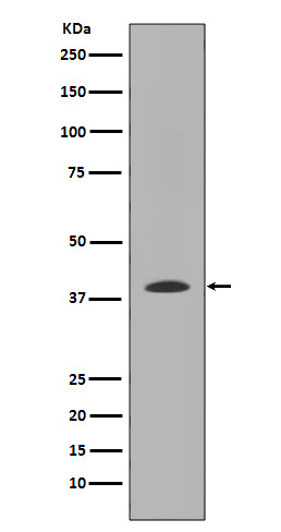 MMP12 Rabbit mAb