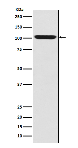 LGR5/GPR49 Rabbit mAb