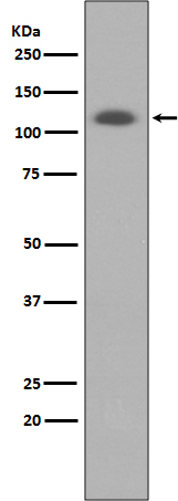 ABCG1 Rabbit mAb