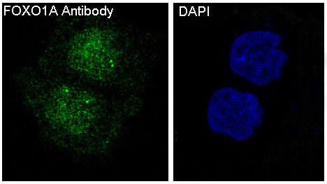 FoxO1a Rabbit mAb