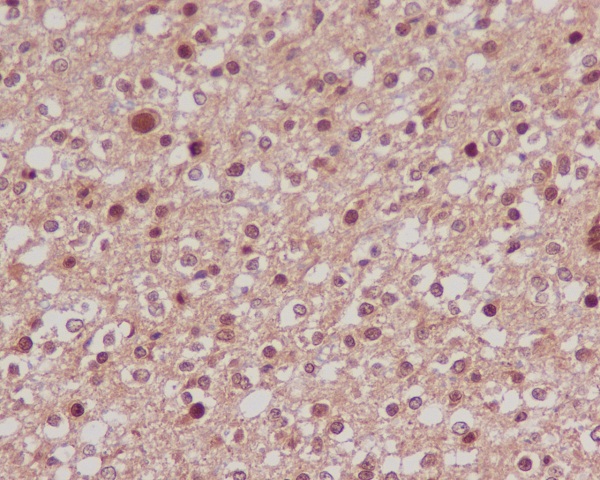 FoxO1a Rabbit mAb