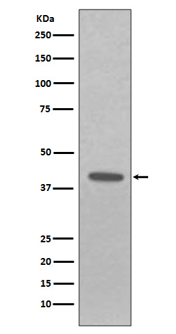 EpCAM Rabbit mAb