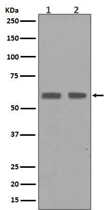 Cyclin B1 Rabbit mAb