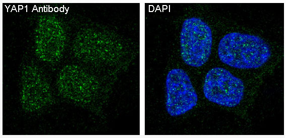 YAP1 Rabbit mAb