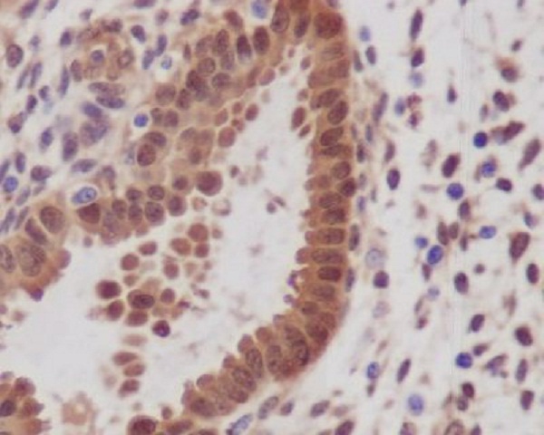 YAP1 Rabbit mAb