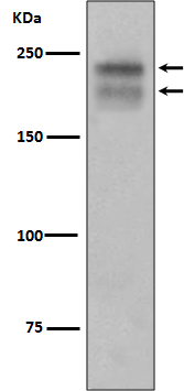 VEGF Receptor 2 Rabbit mAb