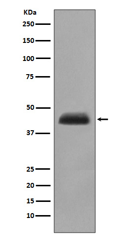 Cytokeratin 15 Rabbit mAb 