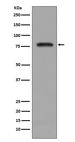 PKC beta 2 Rabbit mAb 