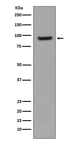 ICAM1 Rabbit mAb 