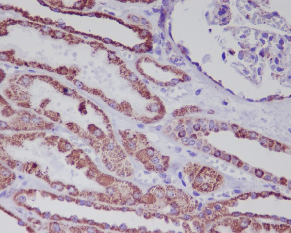 Hsp60 Rabbit mAb 