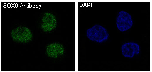 SOX9 Rabbit mAb