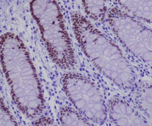 SOX9 Rabbit mAb