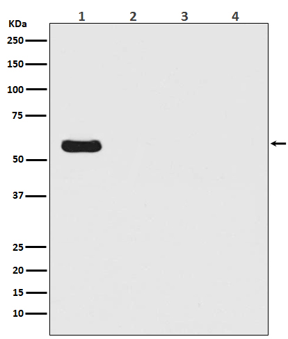 Firefly Luciferase Rabbit mAb