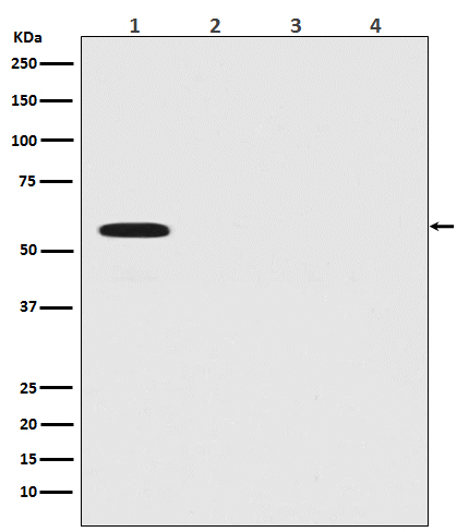 Firefly Luciferase Rabbit mAb