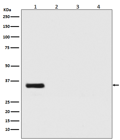 Renilla Luciferase Rabbit mAb