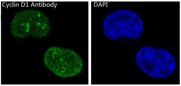 Cyclin D1 Rabbit mAb