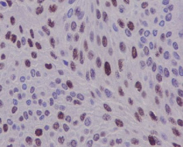 Cyclin D1 Rabbit mAb
