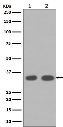 Cyclin D1 Rabbit mAb