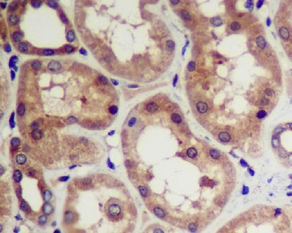 CDK5  Rabbit mAb 