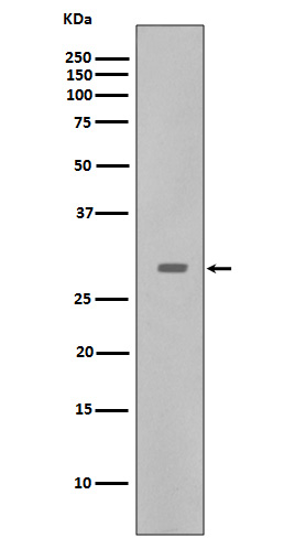 CDK5  Rabbit mAb 