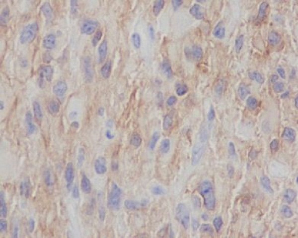 NGFR Rabbit mAb 