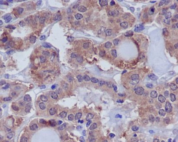 DUSP6 Rabbit mAb