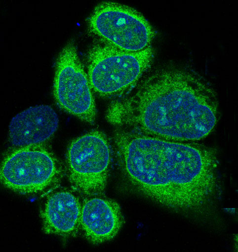 Alkaline Phosphatase Rabbit mAb