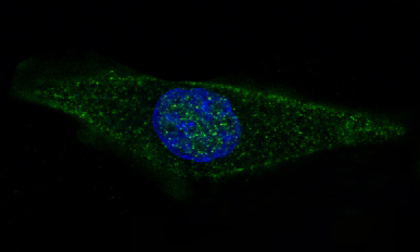 GFAP Rabbit mAb