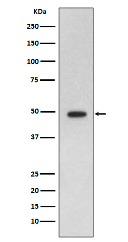 GFAP Rabbit mAb