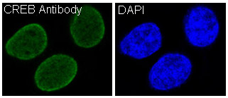 CREB Rabbit mAb