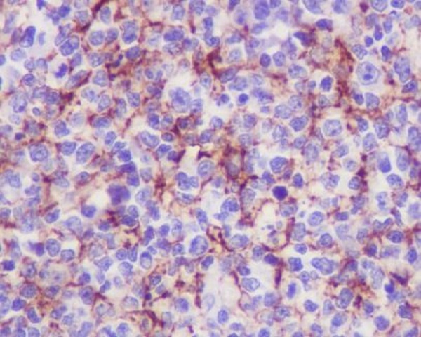 VCAM1 Rabbit mAb