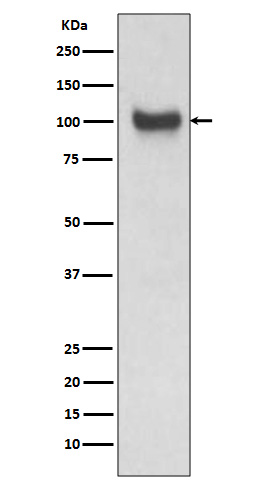 VCAM1 Rabbit mAb