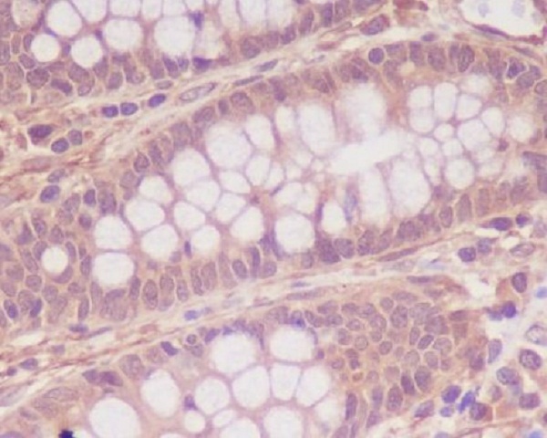 Myosin light chain kinase Rabbit mAb