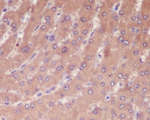 Caspase-1 Rabbit mAb