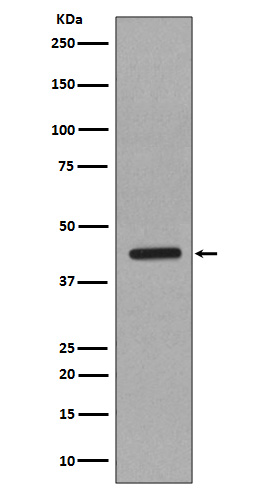 Caspase-1 Rabbit mAb