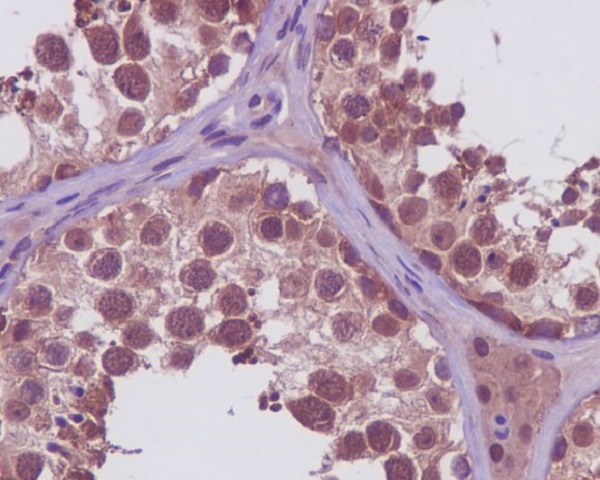 PRMT5 Rabbit mAb 