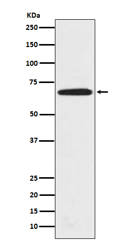 PRMT5 Rabbit mAb 