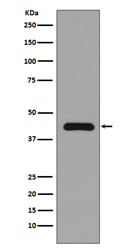 MEK1 Rabbit mAb 