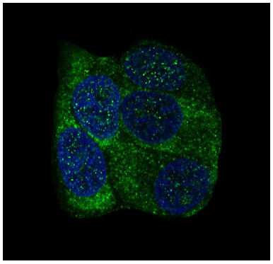 YB1 Rabbit mAb