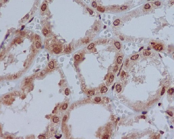 YB1 Rabbit mAb