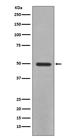 YB1 Rabbit mAb