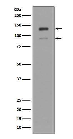 IFNAR1 Rabbit mAb