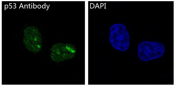 p53 Rabbit mAb